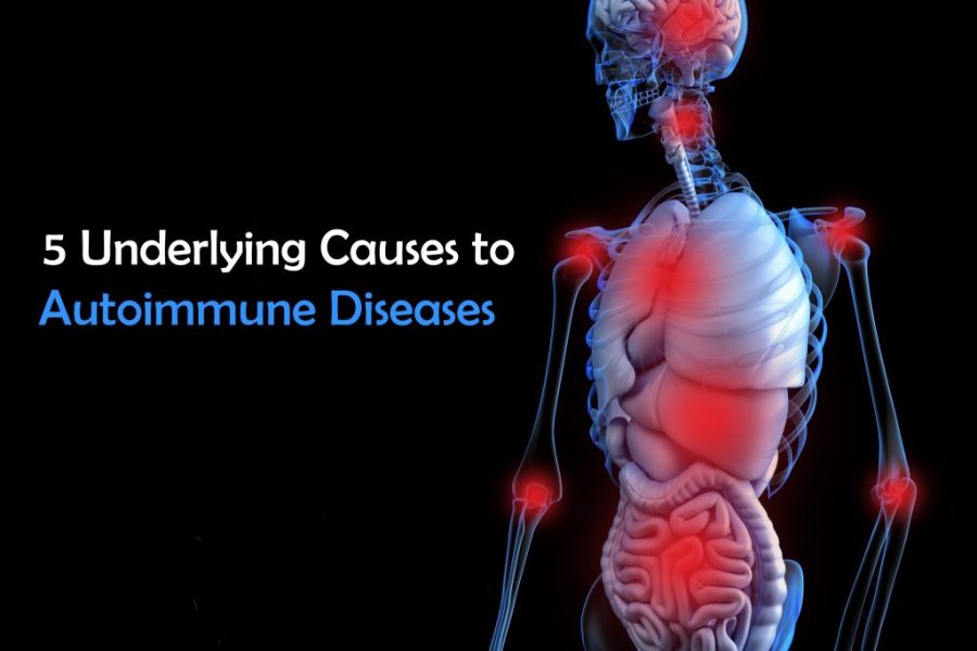 Natural Medicine and Autoimmune – 5 Underlying&nbsp;Causes